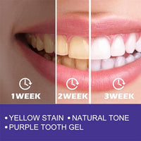 Thumbnail for Purple Whitening Toothpaste