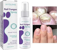 Thumbnail for Nail Fungus Spray