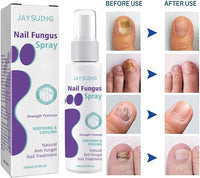 Thumbnail for Nail Fungus Spray