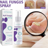 Thumbnail for Nail Fungus Spray