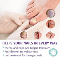 Thumbnail for Nail Fungus Spray