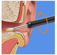 Thumbnail for Earwax Removal Kit